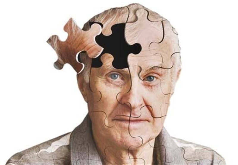 آلزایمر آلزایمر