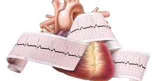نارسایی دریچه میترال