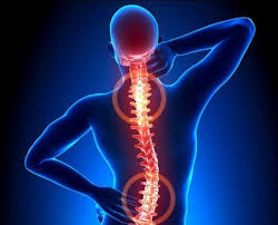 فتق دیسک بین مهرهای فتق دیسک بین مهرهای